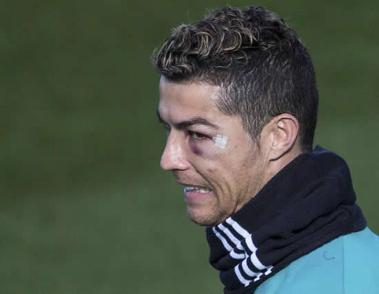 Cristiano Ronaldo trains with black eye after suffering bloody head injury in Real Madrid win against Deportivo