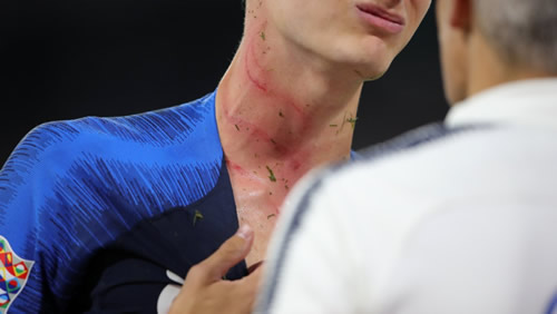Benjamin Pavard Suffers Brutal Injury Marks On His Neck From Antonio Rudiger